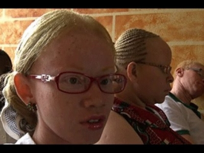 Côte d&#039;Ivoire-Emploi : 300 handicapés dont des albinos intégrés à la fonction publique avant fin juin 2015