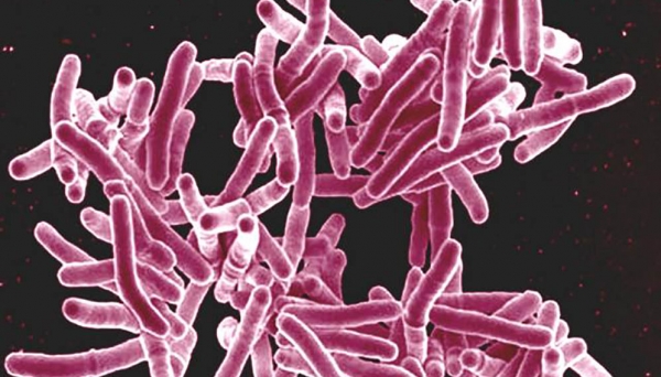 Les cas de tuberculose baissent trop lentement pour atteindre les objectifs fixés pour 2020