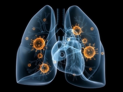 C&ocirc;te d&rsquo;Ivoire : Un atelier pour renforcer la r&eacute;silience des communaut&eacute;s contre la pneumonie
